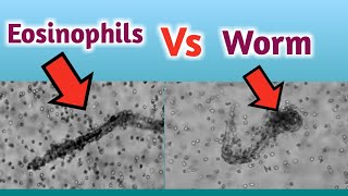 How Eosinophils Coat a Worm [upl. by Mariken8]