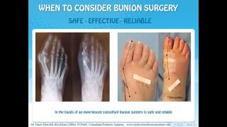 Bunion surgery  Information for patients [upl. by Cavill]