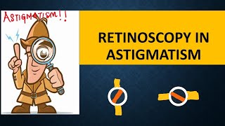 RETINOSCOPY in ASTIGMATISM  Break intensity  brightness and skew  Straddling [upl. by Nodnelg99]