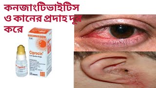 সিপ্রোসিন ড্রপের কাজ কি।Ciprocin eye drop। [upl. by Gothard]