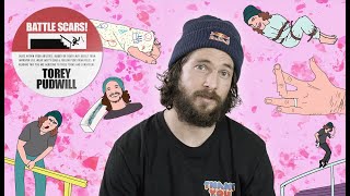 The Worst Injuries Of Torey Pudwill’s Career  Battle Scars [upl. by Ellenahs849]