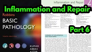 Arachidonic Acid metabolites Robbins pathologyProstaglandins and LeukotrienesInflammatory Mediator [upl. by Ferreby]