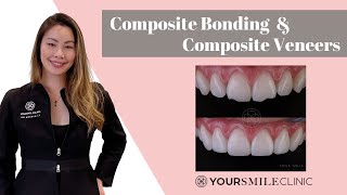 What is Composite Bonding and Composite Veneers What you need to know before you have treatment [upl. by Drawyeh677]