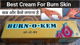 Burn O Kem Cream Antiseptic cream [upl. by Diraf]