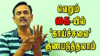 அதிசயம் வெறும் கையில் காய்ச்சலை குணமாக்கலாம் எப்படி  fever treatment in tamil [upl. by Revell]