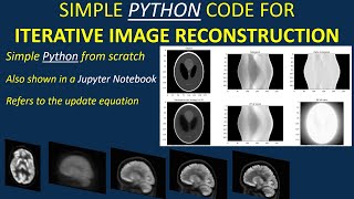 Simple PYTHON code for iterative image reconstruction also shown for a Jupyter notebook [upl. by Catima]