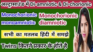 twins kitne prakar ke hote hai dichorionic diamniotic twins in hindi monochorionic diamniotic twins [upl. by Proctor]