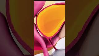 Urinary incontinence causes and symptoms 3danimation medicalanimation [upl. by Milas]