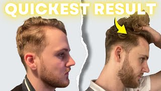 Finasteride and Minoxidil for Quickest Hair Growth Results [upl. by Ylam577]