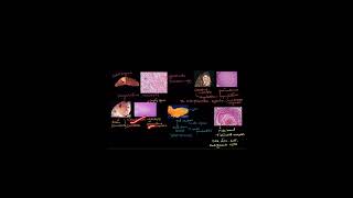 TYPES OF NECROSIS celldamage biology celldeath science cellinjury neet cellulardamage ncert [upl. by Leeban]