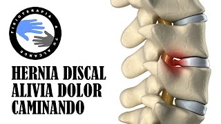 Hernia discal alivia el dolor mientras caminas [upl. by Luigino]