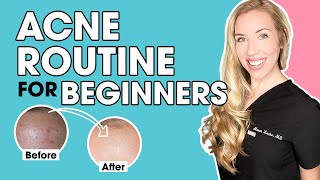 Acne Skincare Routine for Beginners  The Budget Dermatologist [upl. by Owain]