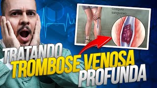 Como tratar uma Trombose Venosa Profunda [upl. by Gun]