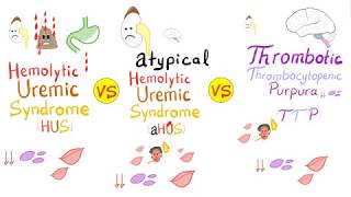 HUS vs aHUS vs TTP [upl. by Nareik630]