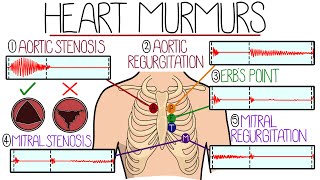 Learn Heart Murmurs In 10 Minutes With Heart Murmur Sounds [upl. by Bergren188]