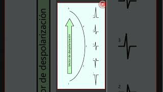 ECG 2  Vector de despolarización [upl. by Illil]