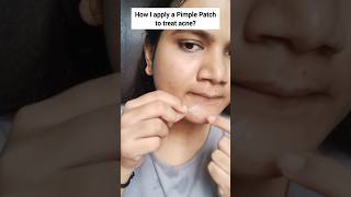 How to apply a pimple patch on face shortsviral youtubeshorts [upl. by Aderfla]