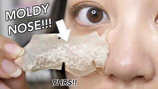 CONGESTED OVERNIGHT BLACKHEAD STRIP My pores SHRUNK dude [upl. by Sachi]