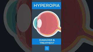 Hyperopia Diagnosis amp treatment  Kenhub hyperopia [upl. by Nivrem191]