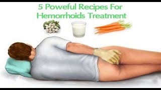 5 Powerful Recipes For Hemorrhoid Treatment [upl. by Eydnarb]