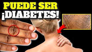 ¡ALERTA PRIMEROS SÍNTOMAS de ALARMA de DIABETES SÍNTOMAS INICIALES DIABETES y PREDIABETES [upl. by Lehcar]