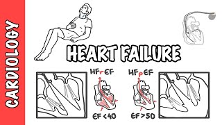 Heart failure with reduced and preserved ejection fraction pathophysiology and treatment [upl. by Washington942]