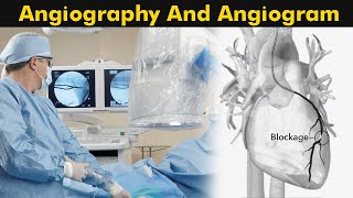 What is Angiography and Angiogram  How Angiography is performed 3D Animation [upl. by Artaed]