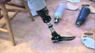 prosthetic leg assembly Echelon  Perfect StrideUltra Strideflex foot [upl. by Oinotla244]