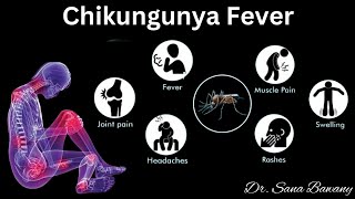 Chikungunya Fever Signs and SymptomsDiagnosis and Treatment [upl. by Immak]