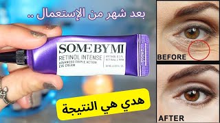 تجربتي مع some by mi retinol eye cream  كريم العين للتجاعيد  retinol [upl. by Mike]