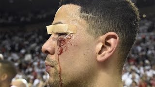 Top 5 Worst Sports Injuries of 2016 [upl. by Pierrepont]