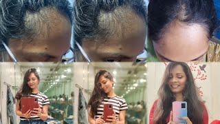 MY HAIR REGROWTH JOURNEY COME SEE MY BABY HAIRS 💃💃✨ I AM SHOCKED 😯 😊✨ [upl. by Varian]