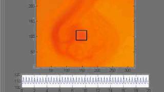 Chick Embryo Heart Rate Analysis  Heart Filling Color Change [upl. by Kenweigh]