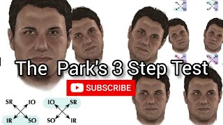 The Parks 3 Step Test Procedure  Eye Movement Disorder and Strabismus Diagnosis [upl. by Ahsiram362]