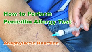 Penicillin G Allergy Test  Benzylpenicillin  Type 1 Hypersensitivity Reaction  How to Do [upl. by Atterg]