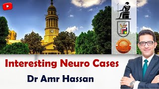 Interesting Neuro Casesأدعمرو حسن الحسني أستاذ المخ و الاعصاب [upl. by Dalis]