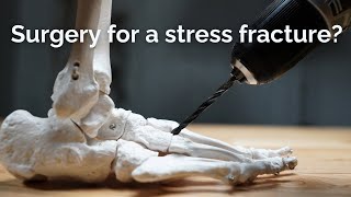 Stress Fracture Surgery What You Need to Know [upl. by Siraf43]