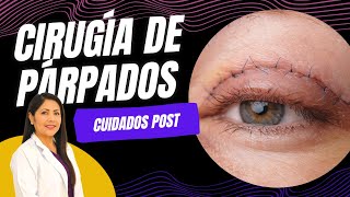 Cuidados Después De Tu Blefaroplastia 👁️ Post Quirúrgico Cirugía de Párpados ❤️ Dra Lizbeth Zuñiga [upl. by Aicatsanna]