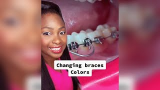 Does changing braces colors hurt hygienist braces [upl. by Asiulana662]