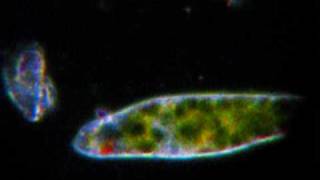 Euglena in Darkfield at 100X 200X and 400X [upl. by Atokad]