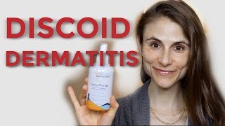 DISCOID NUMMULAR DERMATITIS TIPS FROM A DERMATOLOGIST DR DRAY [upl. by Annoynek]