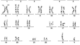 Difference between Male karyotype vs Female karyotype karyotype biology [upl. by Critta210]