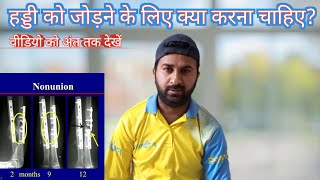 हड्डी को जोड़ने के लिए क्या करना चाहिए  Tibia Fibula Femur ampOther Fractures Recovery [upl. by Fawcett]