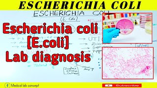 Escherichia coliEcoliLab diagnosisMedical Lab Concept [upl. by Yellek]