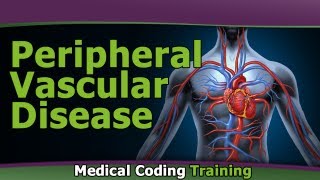 Peripheral Vascular Disease  ICD9 Coding for Beginners [upl. by Hoffert]