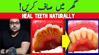 Dr ZeeNatural Remedy for dental Plaque Cavities and Gingivitis [upl. by Ydna]