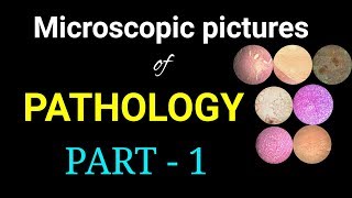 Microscopic pictures of pathology I Dr Poojireddy [upl. by Nnalyrehs962]