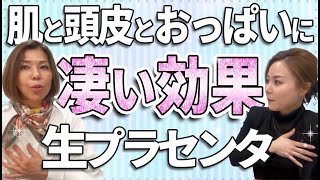 発毛、バストUPにも 化粧品に恨みしかなかった過去を98生の非変性プラセンタで作る美しい肌に変えた [upl. by Manuel]