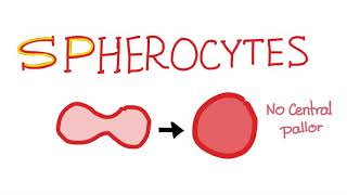 Spherocytes [upl. by Zetrac]