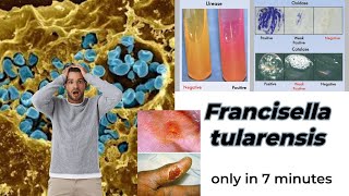 Francisella microbiology lecture  Francisella tularensis Easy Microbiology [upl. by Niriam]